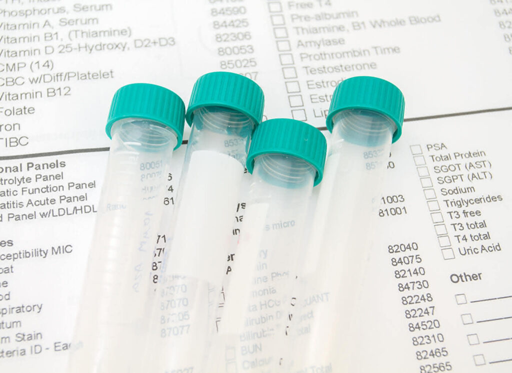 devon-rex-cats-fully-DNA-tested-sires-lab-test-tubes